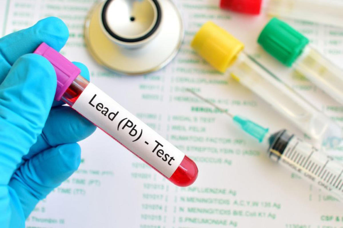 lead blood test